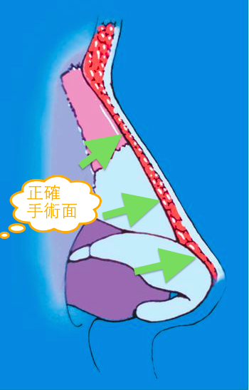鼻部軟組織結構,博恩妍