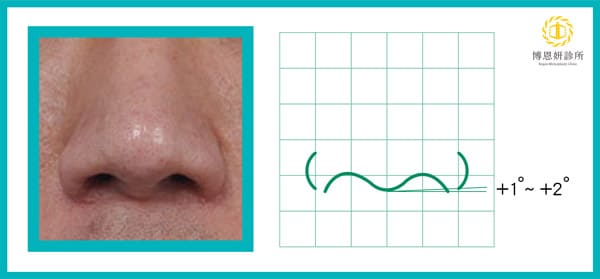 博恩妍診所張簡醫師詳述鼻小柱內收黃金夾角