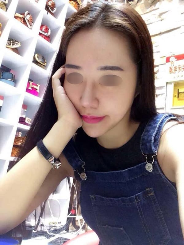 重修鼻整形手術費用,張簡仕煌醫師,鼻重修,博恩妍