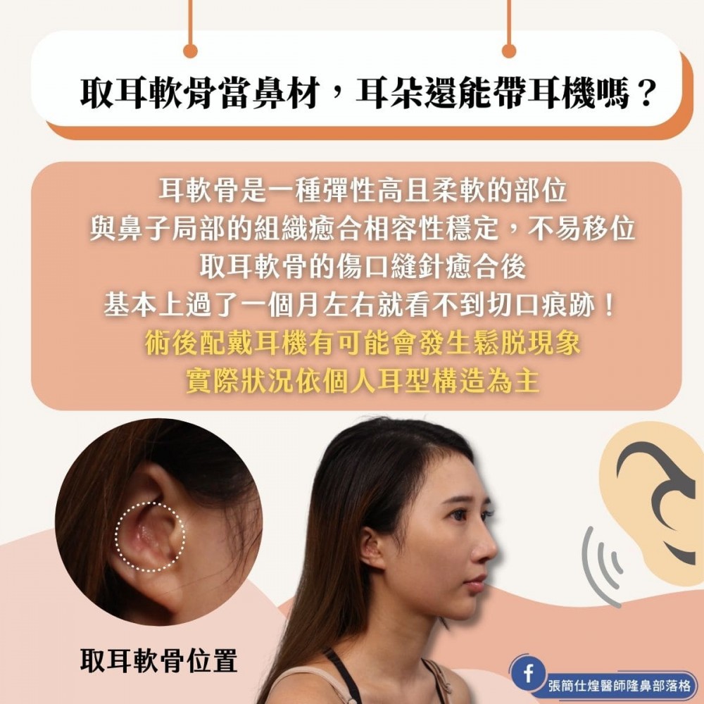 鼻子整形取耳軟骨還可以帶耳機嗎,博恩妍