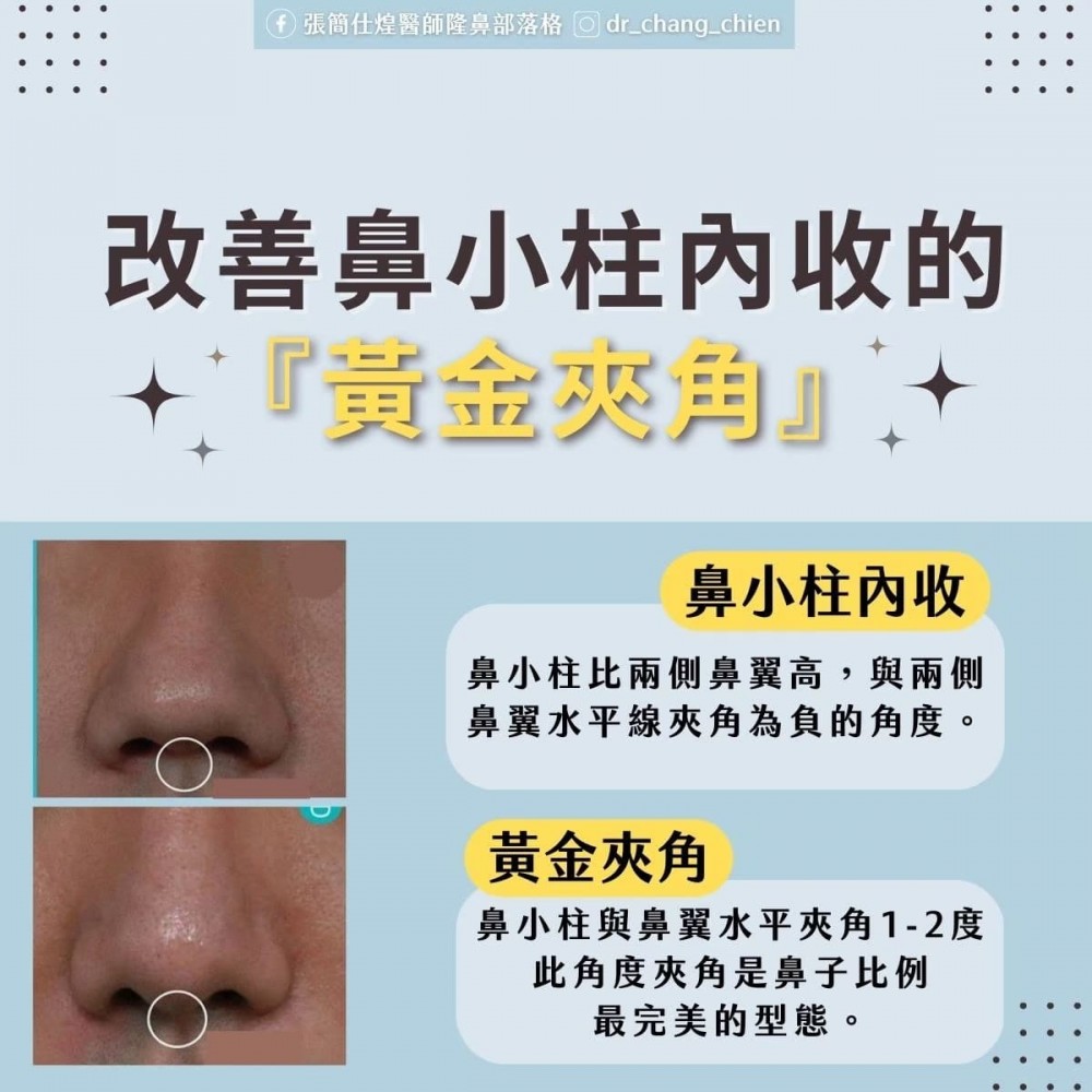 改善鼻小柱的黃金夾角,鼻子黃金比例,博恩妍