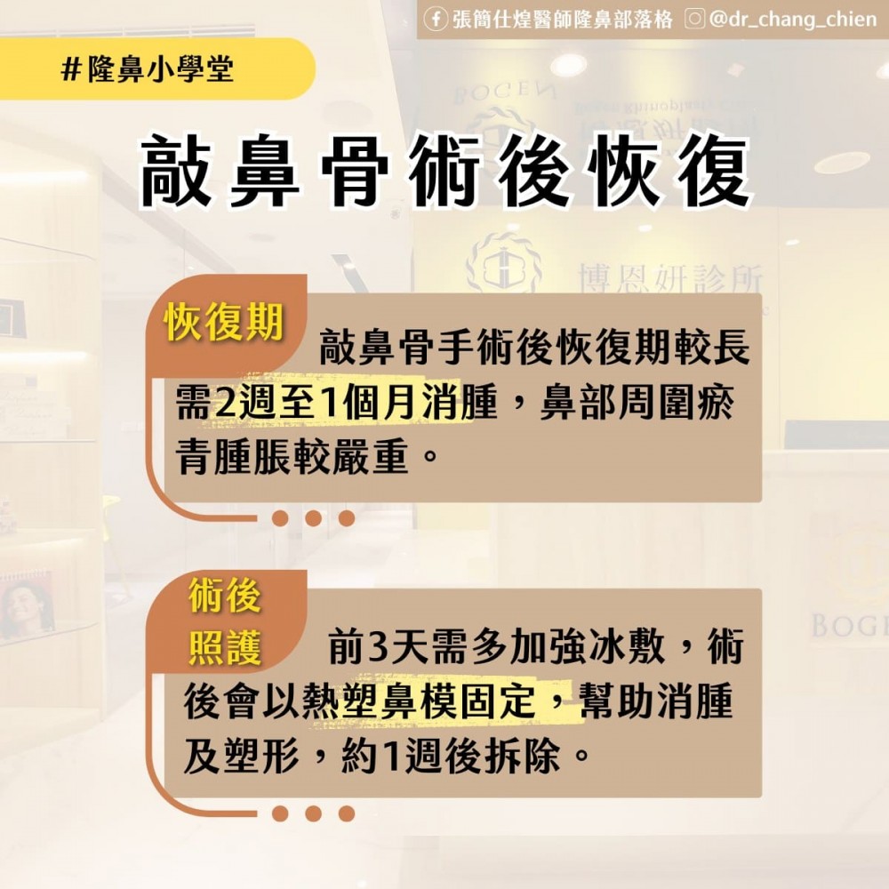 敲鼻骨術後恢復期需2周至1個月,敲鼻骨手術,博恩妍