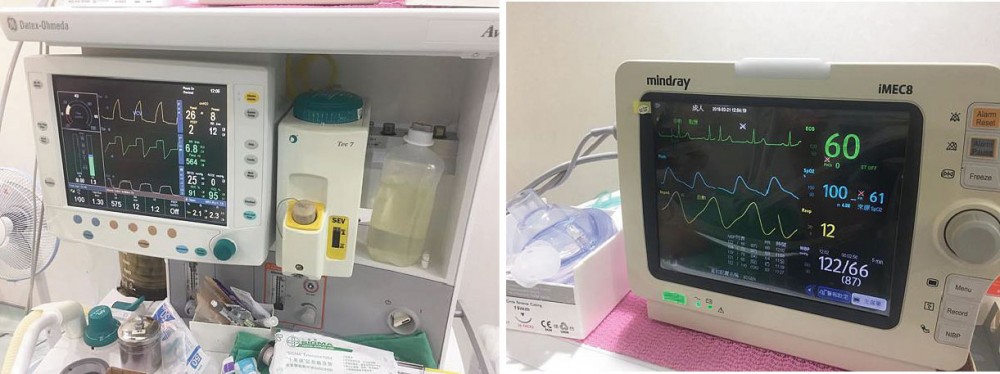 保障抽脂手術安全的專業麻醉設備,博恩妍