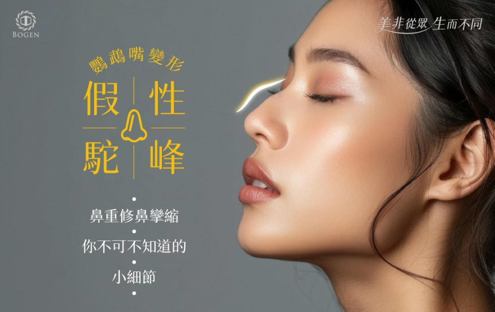 假性駝峰(鸚鵡嘴變形)，鼻重修你不可不知的小細節,假性駝峰,駝峰鼻,博恩妍