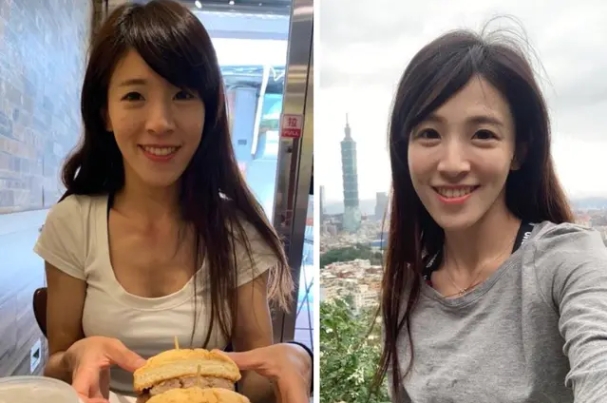 正顎手術案例分享,正顎手術,博恩妍