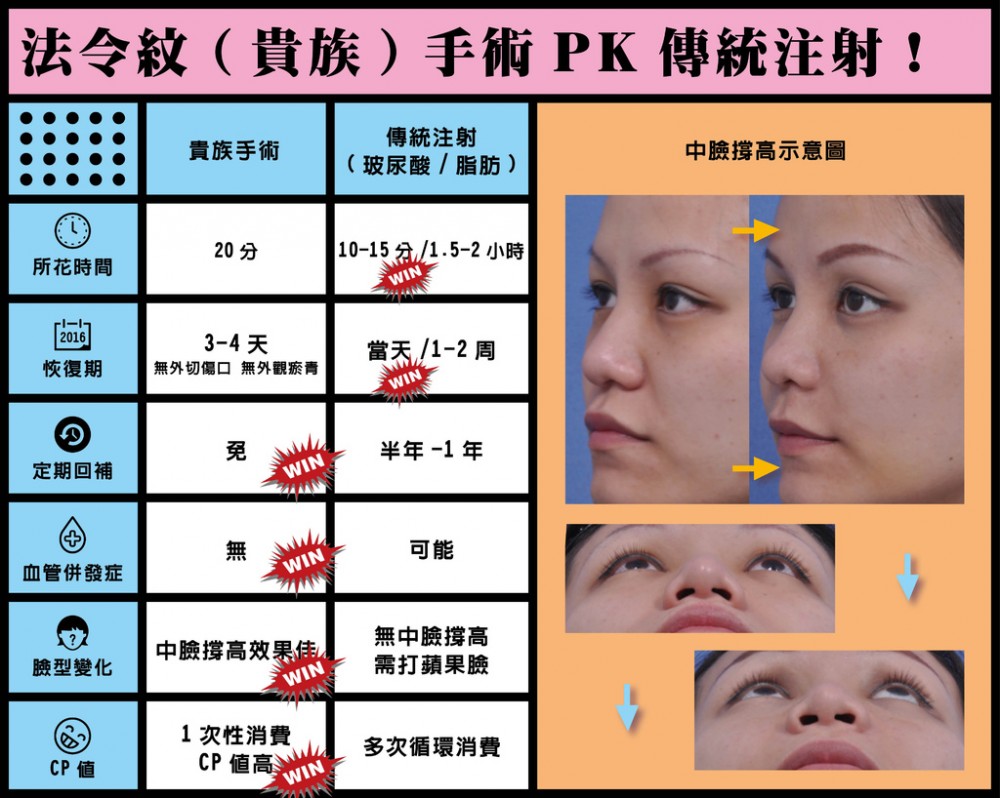 法令紋貴族手術比較,法令紋貴族手術,法令紋,博恩妍
