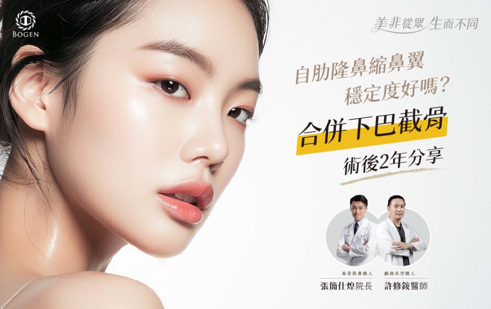 自肋隆鼻縮鼻翼穩定度好嗎？ 合併下巴截骨術後2年分享,自肋隆鼻縮鼻翼,下巴截骨,隆鼻下巴手術,博恩妍