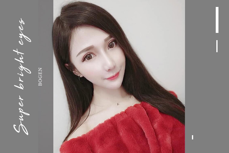 雙眼皮重修+眼袋手術+自體脂肪補臉案例,複合式手術,博恩妍