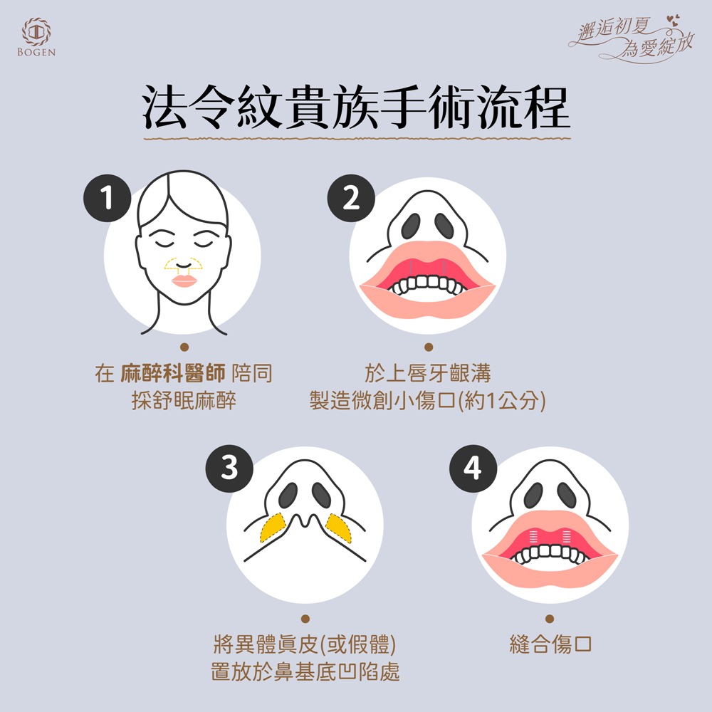 法令紋貴族手術流程,法令紋貴族手術,博恩妍