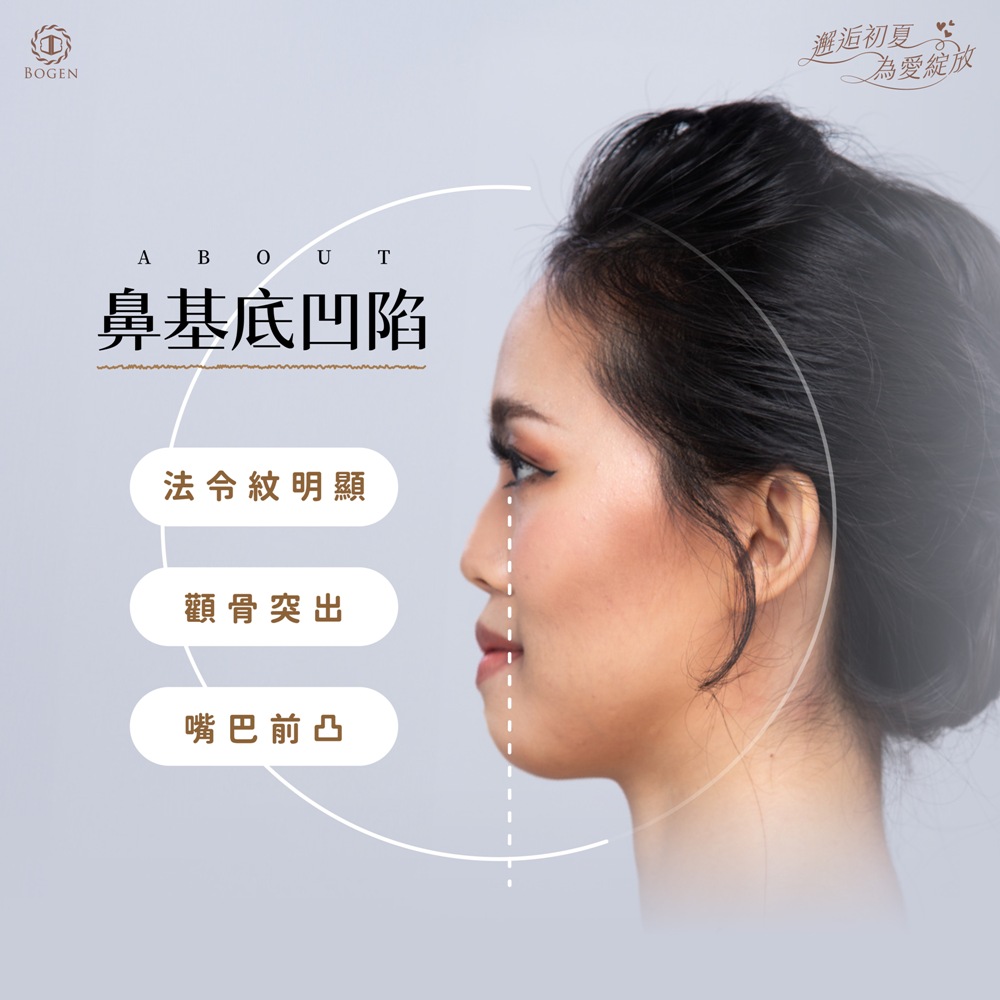 鼻基底凹陷,鼻基底,博恩妍