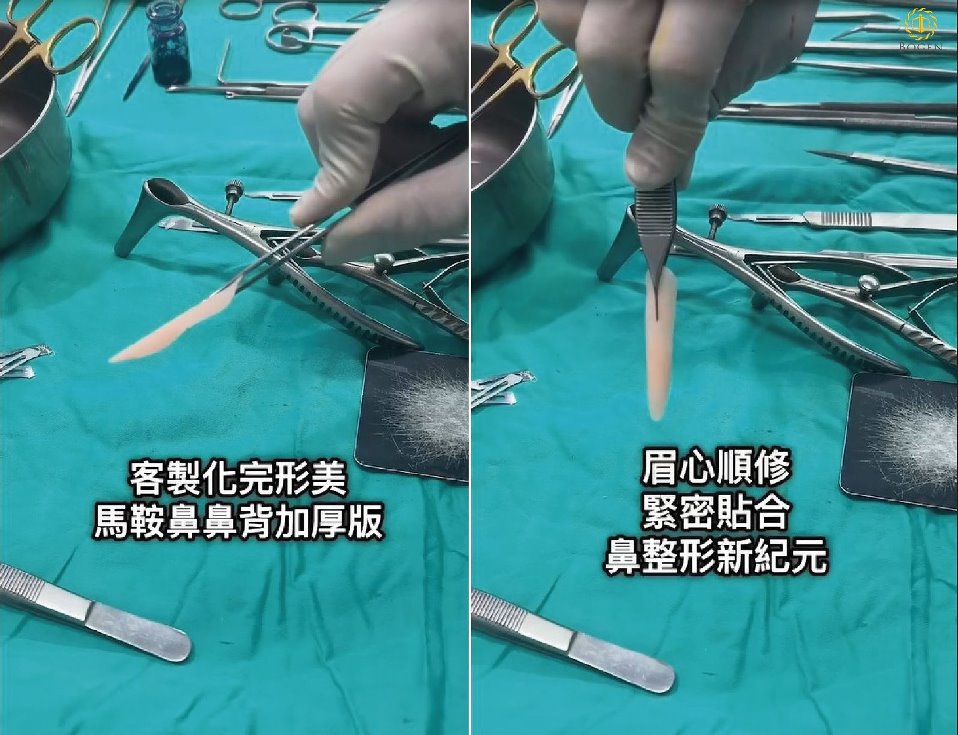 完形美客製化鼻模改善馬鞍鼻,馬鞍鼻矯正,博恩妍