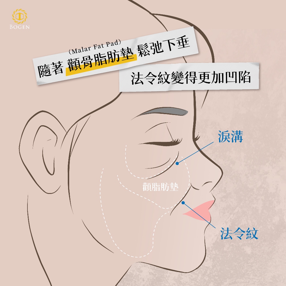 脂肪墊下垂造成法令紋,博恩妍