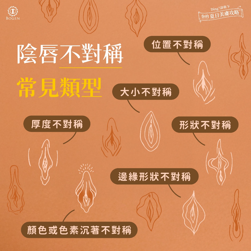 陰唇不對稱常見種類,陰唇不對稱,博恩妍