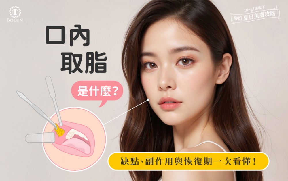 口內取脂是什麼？缺點、副作用與恢復期一次看懂！