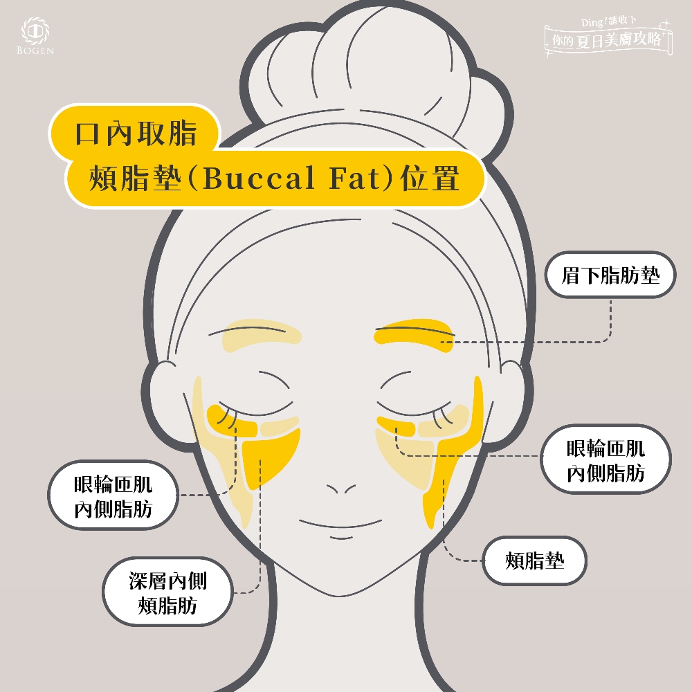 口內取脂,口內取脂位置,博恩妍