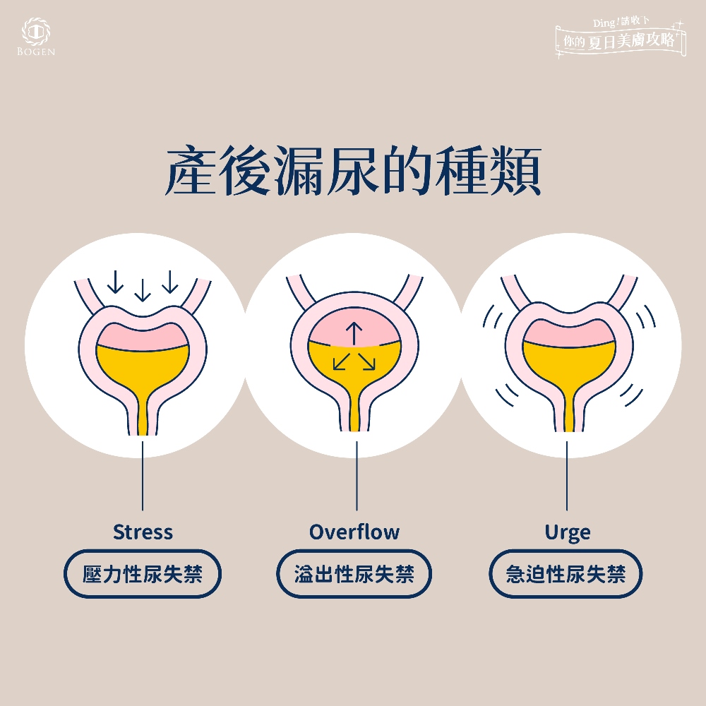 產後漏尿種類,產後漏尿,博恩妍