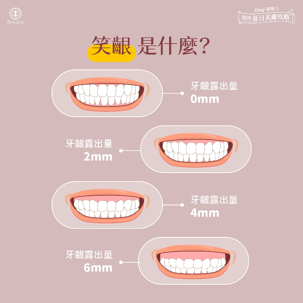 笑齦,笑露牙齦,笑齦是什麼,博恩妍