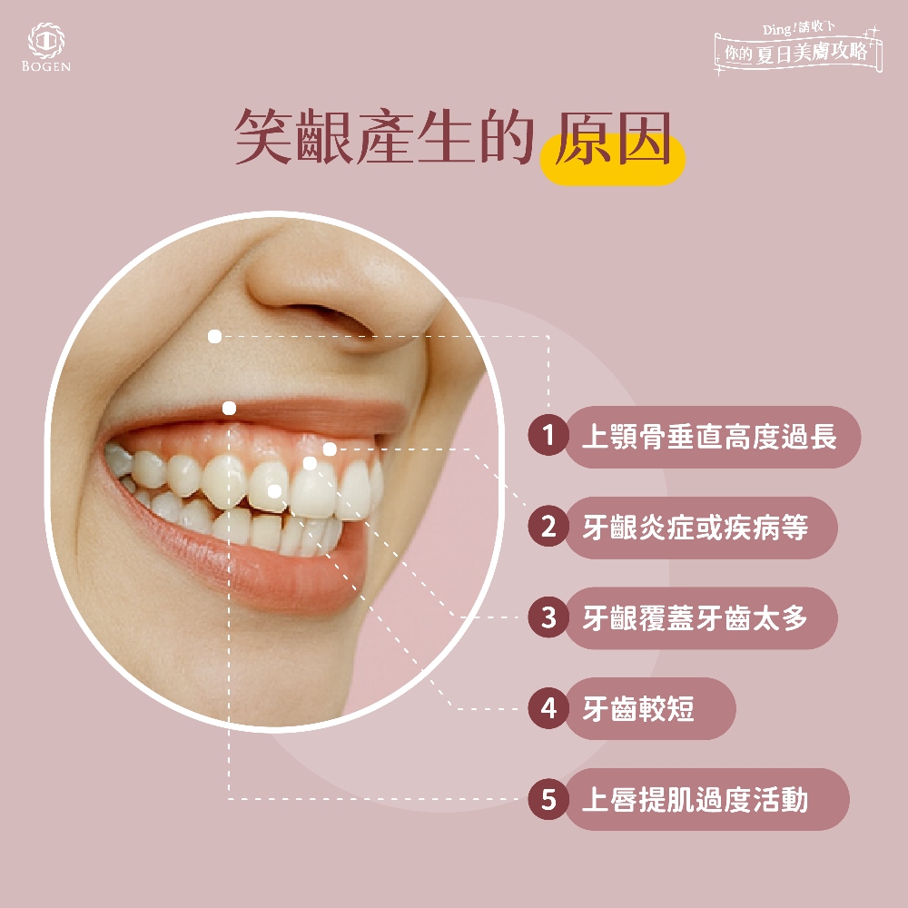 笑齦原因,笑露牙齦原因,博恩妍