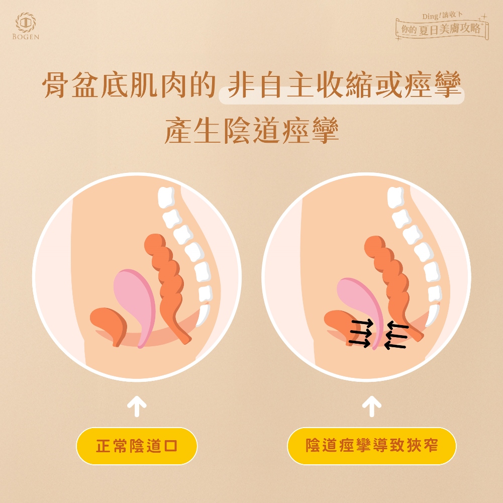 陰道痙攣是什麼,陰道痙攣,博恩妍