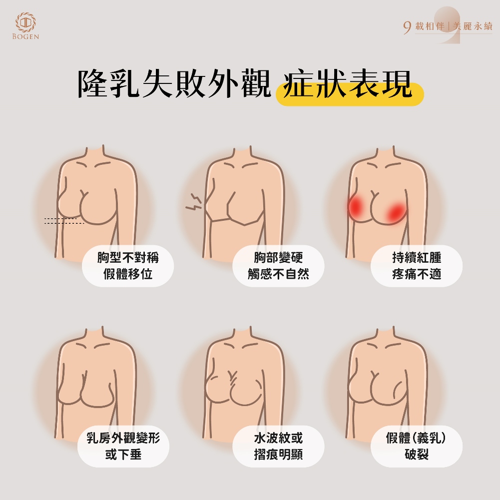 隆乳失敗外觀症狀,隆乳失敗,博恩妍