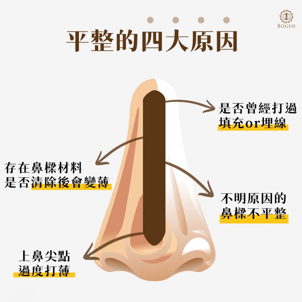 鼻樑不平順的4大原因,鼻樑不平順,博恩妍
