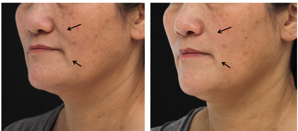 鳳凰電波案例,鳳凰電波,博恩妍