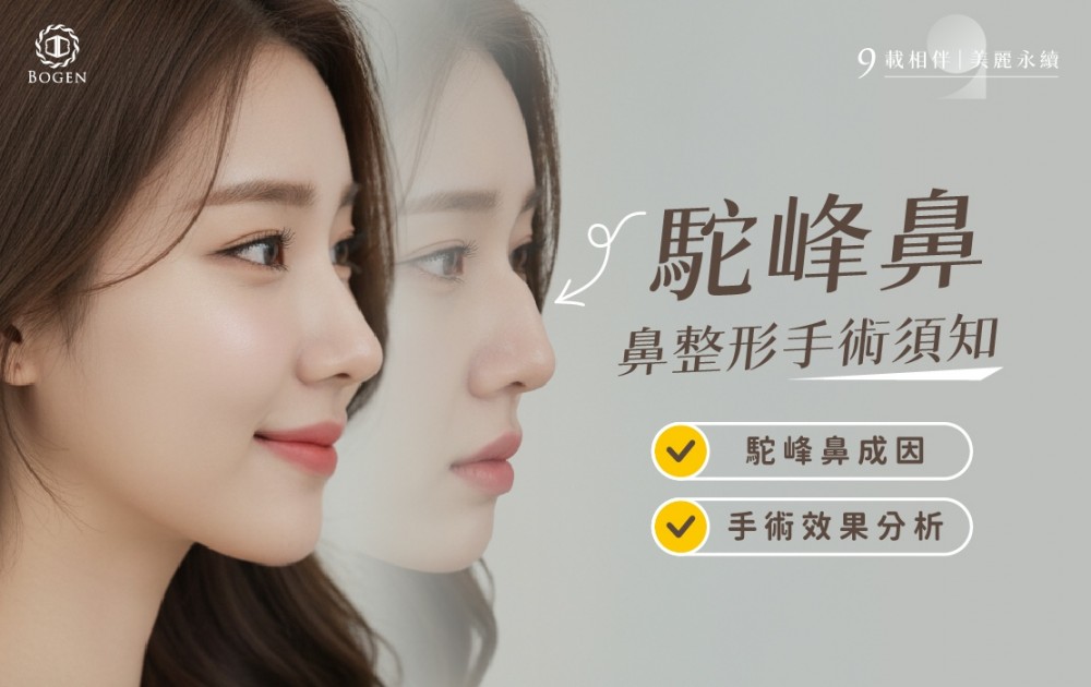 駝峰鼻鼻整形手術須知,駝峰鼻,博恩妍