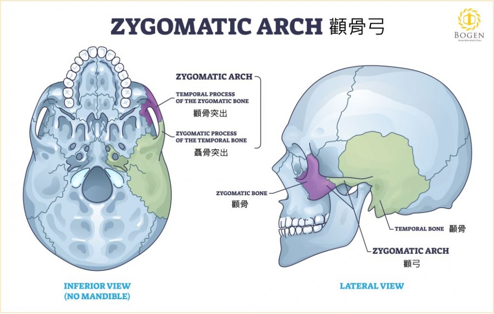 顴骨突出是什麼,顴骨突出,博恩妍