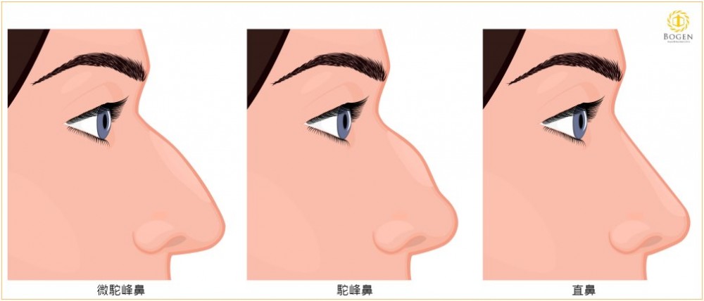 微駝峰鼻,駝峰鼻,直鼻,博恩妍