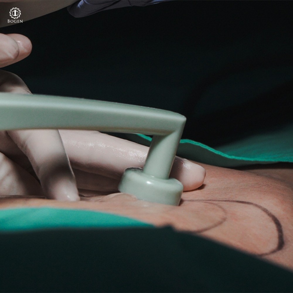 鈦特離子夾,鈦特離子夾治療皮膚鬆弛,博恩妍