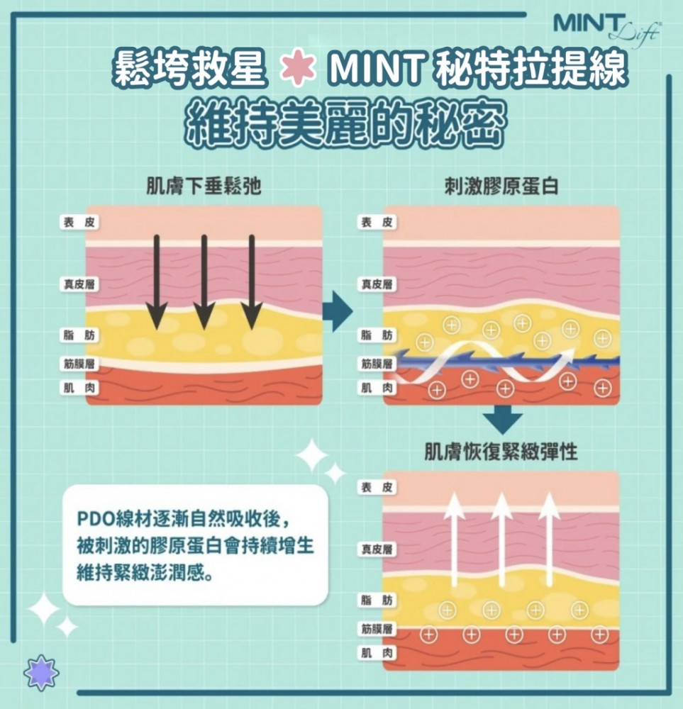 MINT秘特拉提線刺激膠原增生恢復緊緻彈性,MINT秘特拉提線,博恩妍