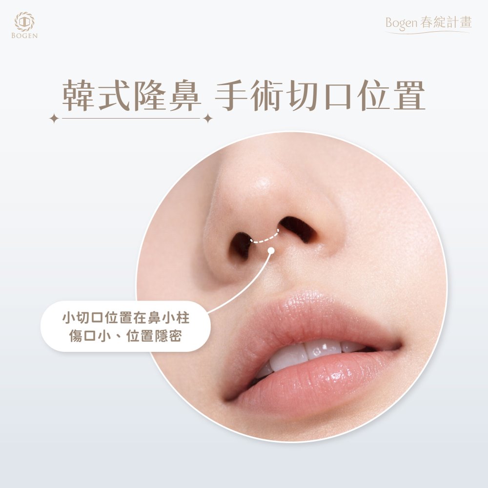 韓式隆鼻手術切口位置,韓式隆鼻,博恩妍