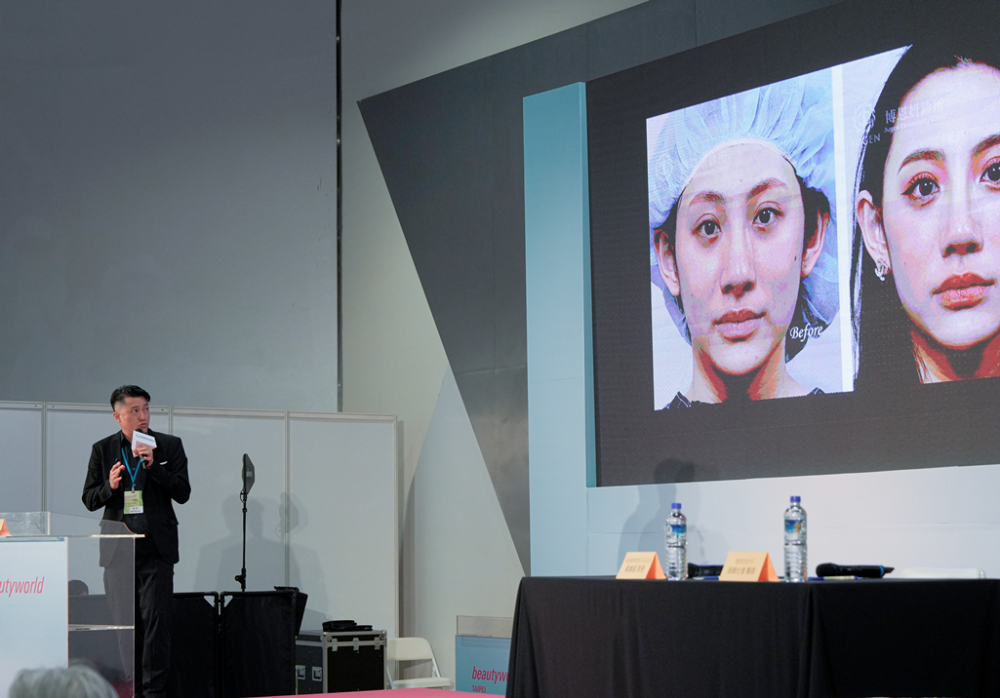 台灣美容外科學會分享：從長鼻鼻整形談臉部年輕化手術關鍵,張簡仕煌醫師,博恩妍