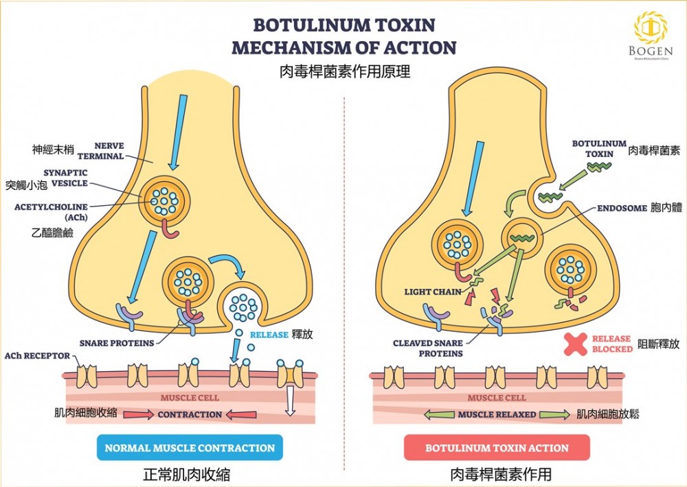 咀嚼肌肉毒桿菌作用原理,肉毒桿菌作用原理,博恩妍