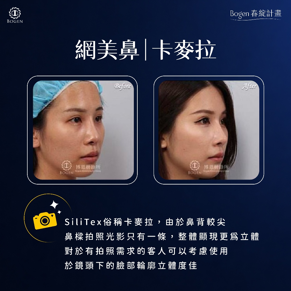 卡麥拉,卡麥拉是什麼,卡麥拉隆鼻,博恩妍