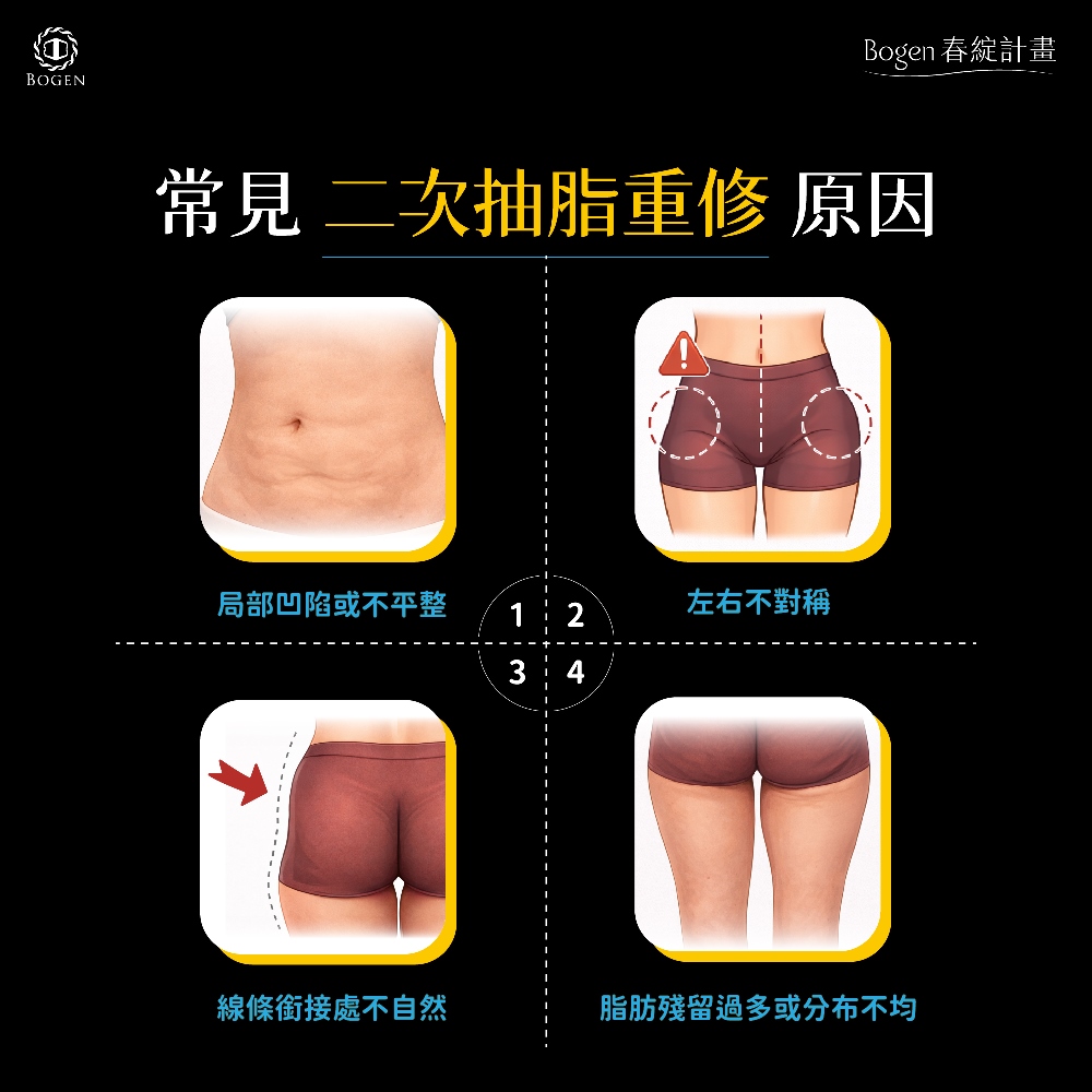 二次抽脂重修常見原因,二次抽脂重修,博恩妍