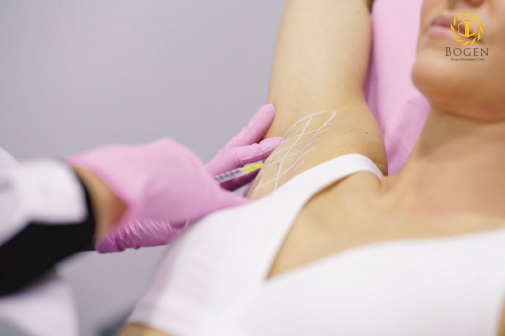 腋下止汗肉毒,肉毒腋下止汗,肉毒止汗,博恩妍