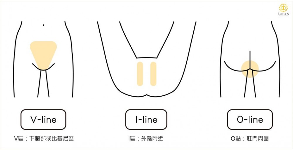 私密處除毛,VIO除毛,博恩妍