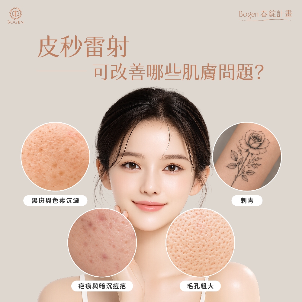 皮秒雷射效果好嗎？可以改善哪些問題？,博恩妍