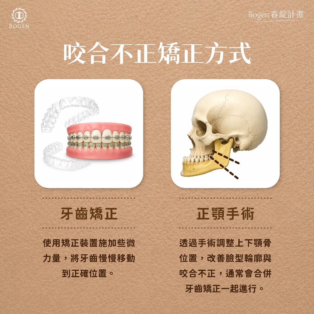 咬合不正矯正方式,咬合不正改善,博恩妍