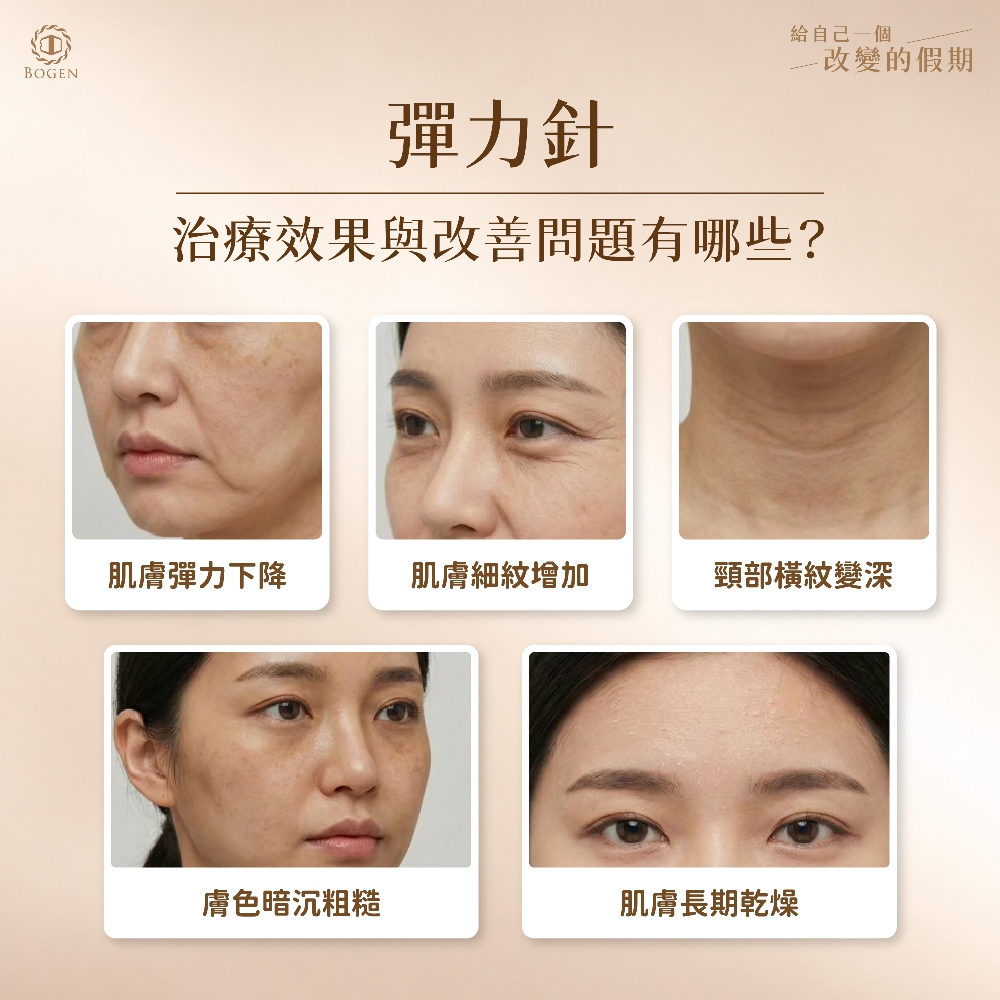 彈力針效果,彈力針能改善問題,博恩妍