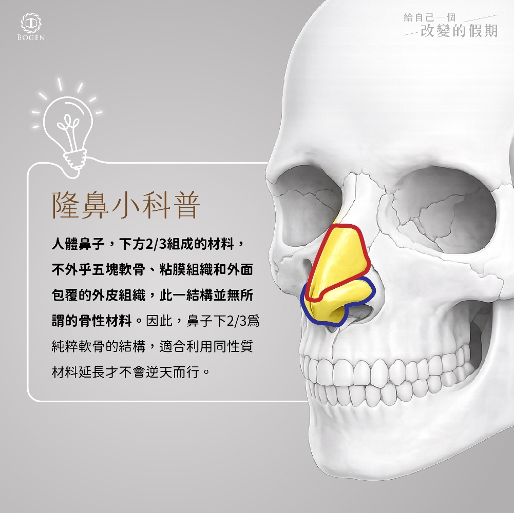 人工骨為什麼不適合用於鼻頭延長,人工骨缺點,博恩妍