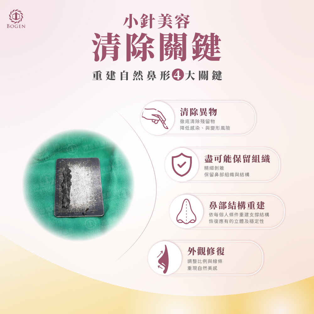 植入物清除,王彩樺,小針美容,鼻重修,清除關鍵