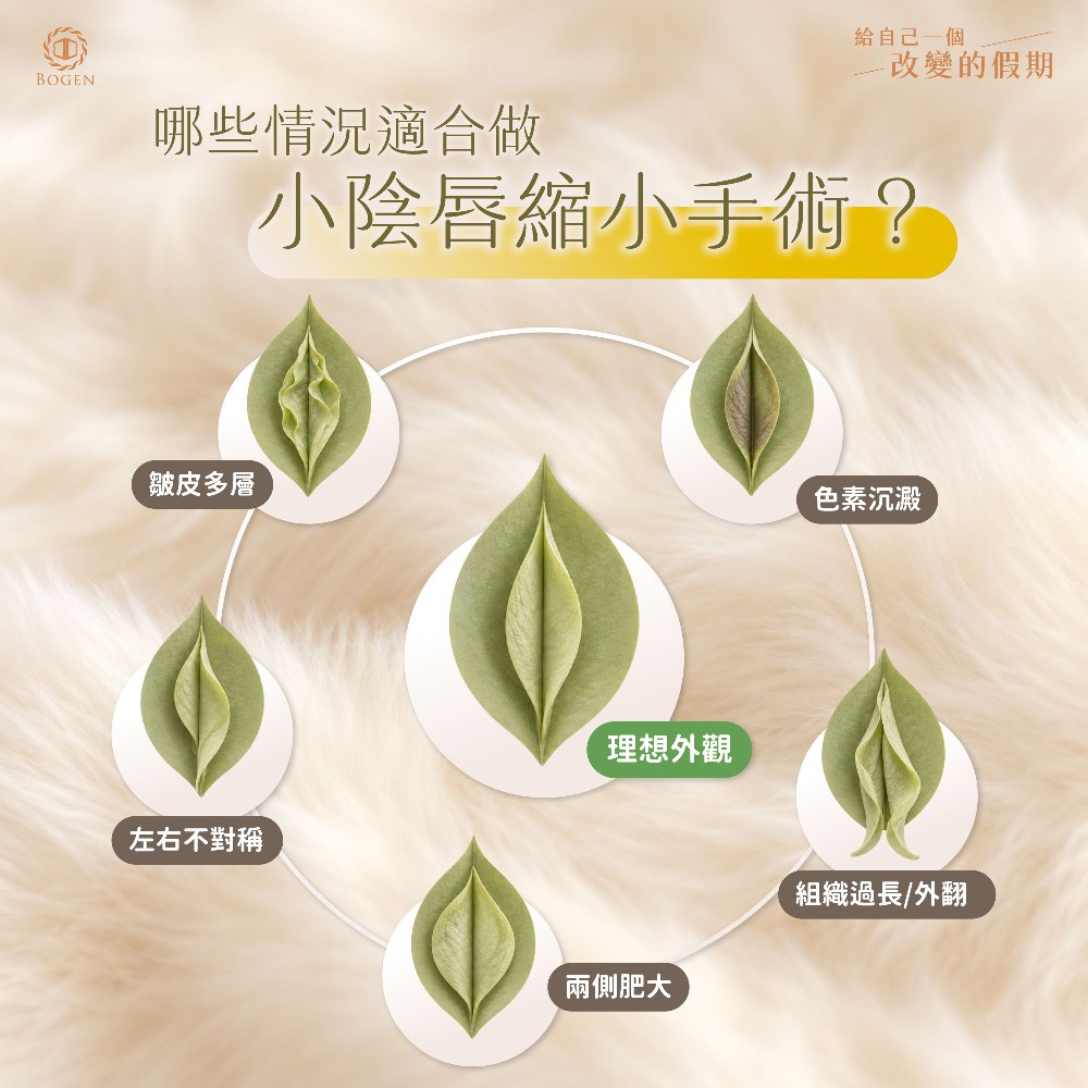 哪些情況適合做小陰唇縮小手術,博恩妍
