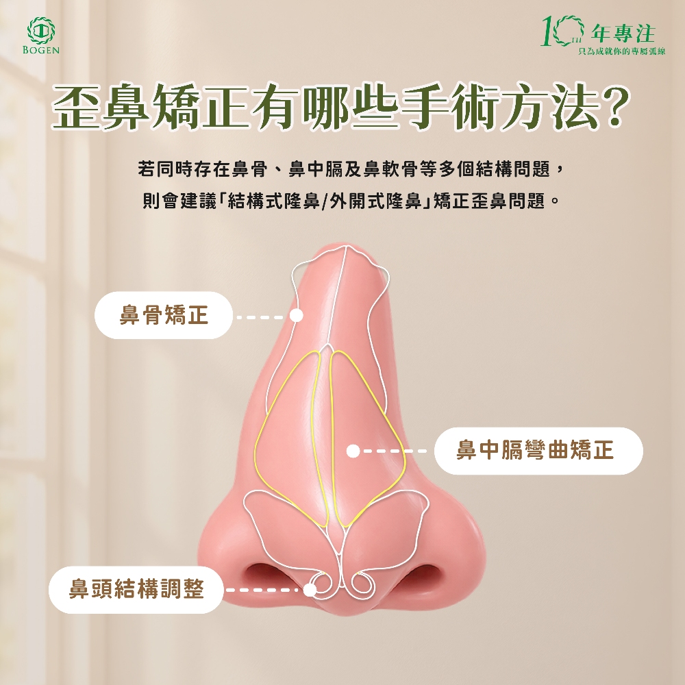 歪鼻矯正手術有哪些,歪鼻矯正,歪鼻手術,博恩妍