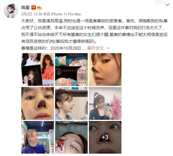 隆鼻失敗,鼻頭壞死黑掉,博恩妍