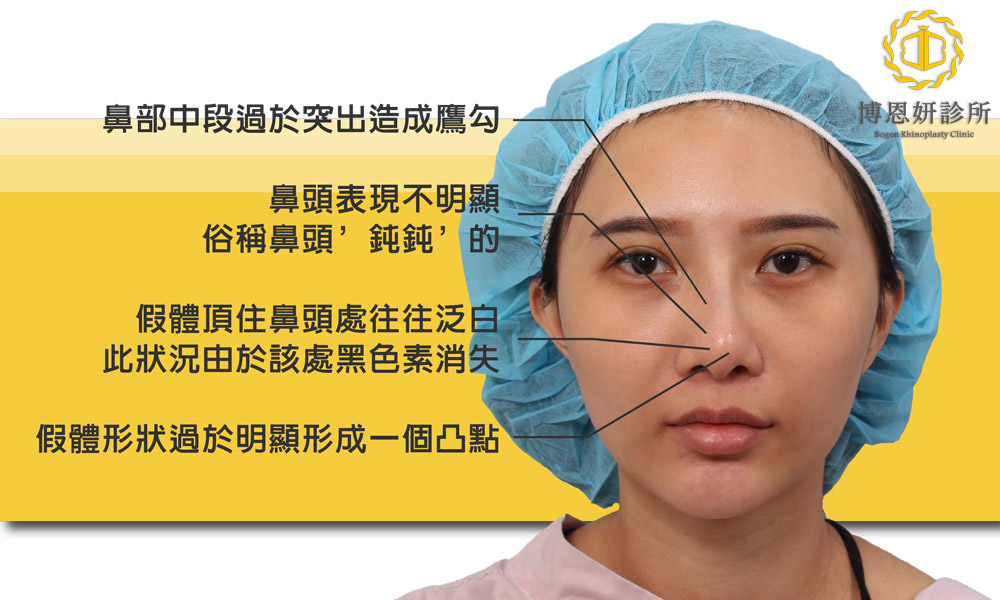 博恩妍診所張簡醫師歪鼻鼻整形案例問題分析