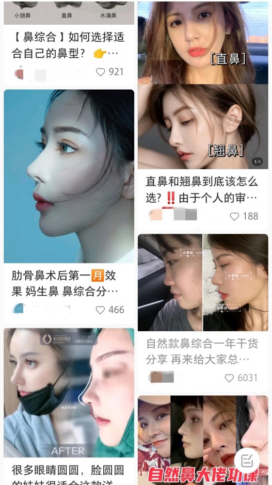 小紅書網紅鼻,網紅鼻