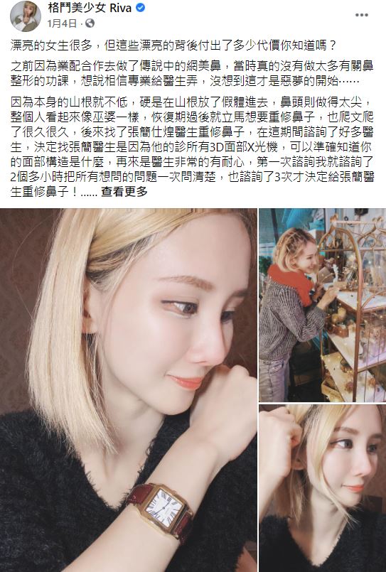網紅鼻重修,鼻重修案例,鼻重修心得分享,博恩妍